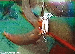 [S̃XN[